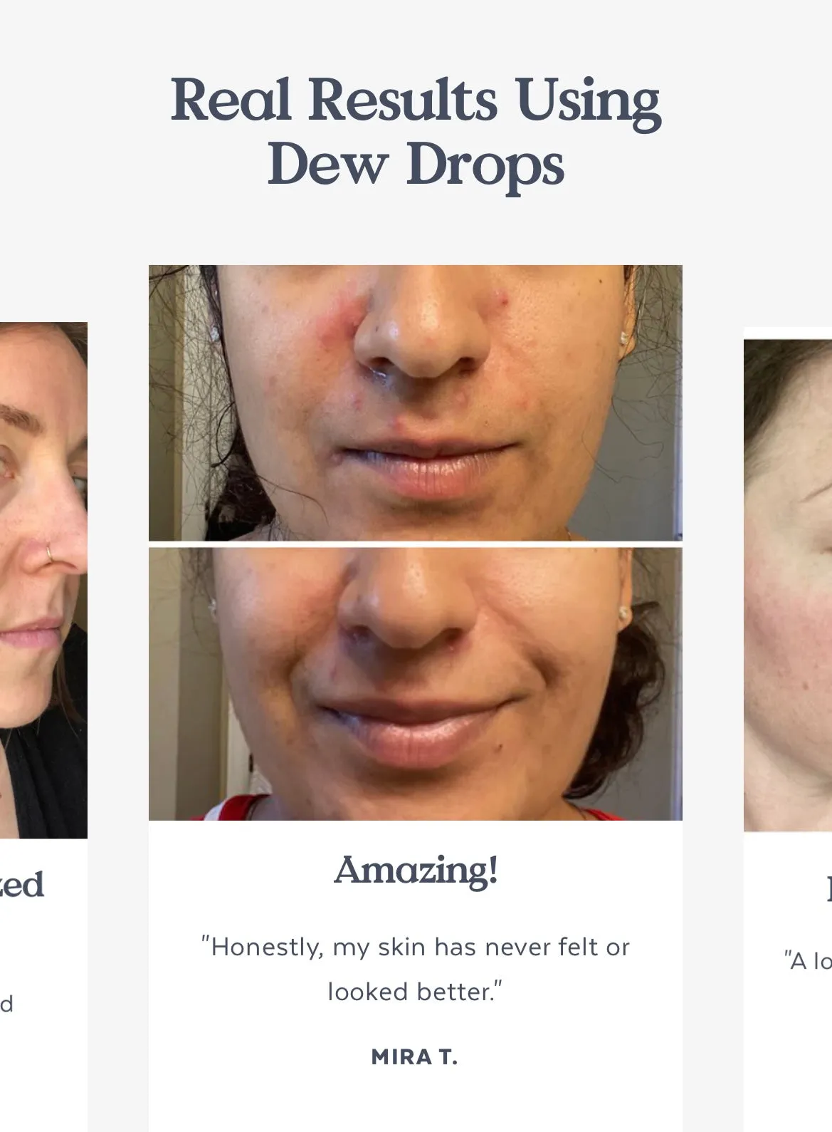 Dew Drops Serum